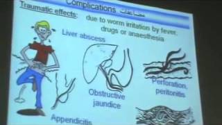 Dr Azza   Helminths   class Nematoda 1   Ascaris Lumbricoides   YouTube