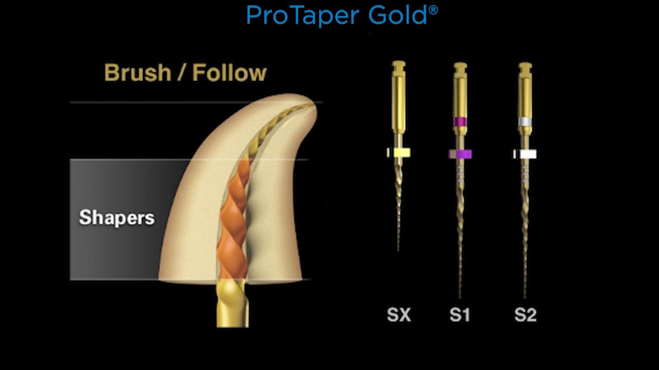 Canal Preparation with ProTaper Gold (En Anglais)