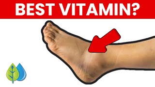 Top 5 Nutrients To Reduce Swelling In Feet & Legs