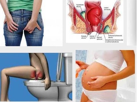 Exciter bagi perempuan untuk membeli pengiriman Cepat di Moskow Bagaimana membangkitkan seorang gadis secara online
