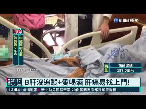 肚臍周圍"瘀青" 壯年男就醫已肝癌末