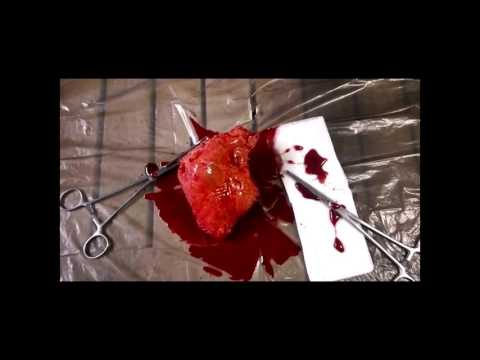 EXPERIMENT IN TERROR - Heart Ripped Out - Special FX