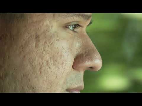 Pedro Hernandez MPD Video