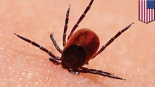 Lyme disease: What to do if you get bitten by a tick - TomoNews