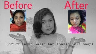 Download lagu mencerahkan kulit dengan cepat | Review sabun Kojie San Kojic Acid Soap | cara mencerahkan kulit mp3