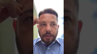 Hair system review- CRISIS DIVERTED!