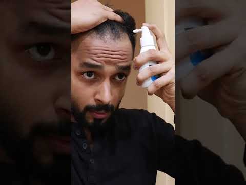 How does minoxydil work #shorts