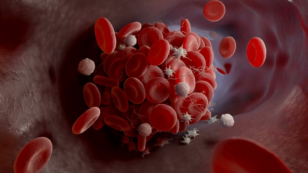 VASOLAB - Carotid Artery Video thumbnail