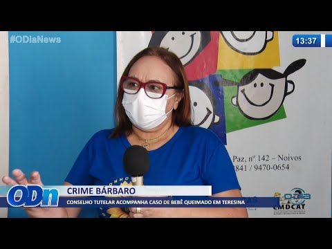 Conselho Tutelar acompanha caso de bebê queimado em Teresina 24 02 2022