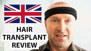 Hair Transplant Patient Review: Hello UK! John's Hair Transplant Experience at AEK Hair Clinic