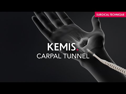 Surgical technique - Carpal Tunnel - Kemis H3