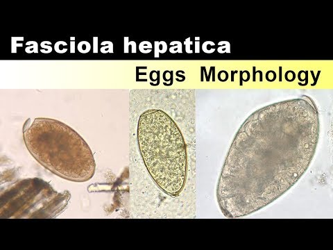 a fascioliasis fertőzésének módjai gomba recept