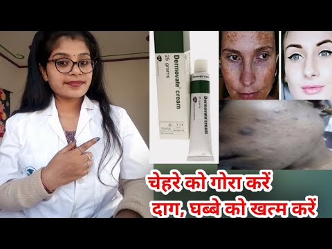 Dermovate Cream,Dermovate cream honest review,Dermovate cream benefits uses & side effects in hindi