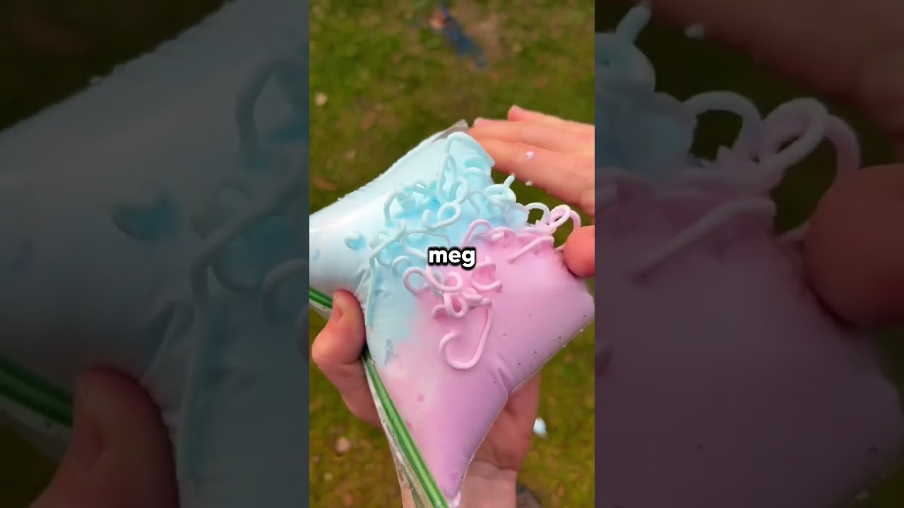 Kona Var Dopa På Morfin Etter Keisersnitt Og Ga Babyen Feil Navn, Nå Sitter Vi Fast Med Det