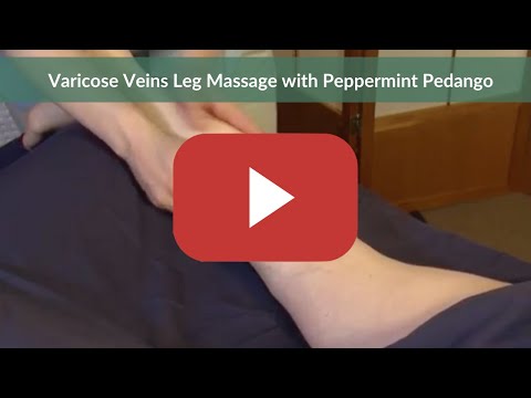 Varicose Veins...