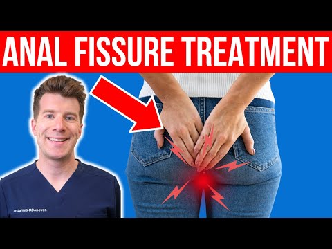 10 Tips to Help With Anal Fissure Symptoms
