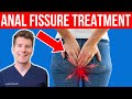 10 Tips To Help With Anal Fissure Symptoms