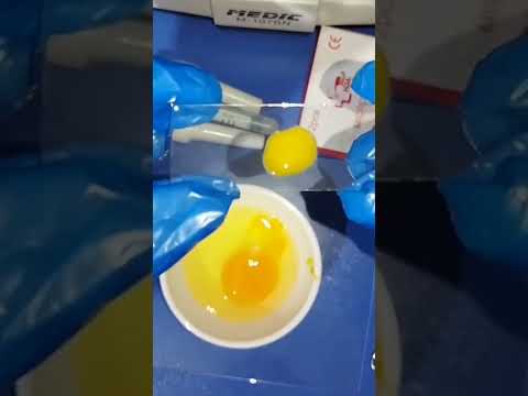 eggs under microscope #science #microbiology #microscopy