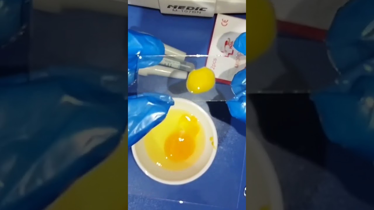 eggs under microscope #science #microbiology #microscopy