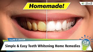 Simple and Easy Teeth Whitening Home Remedies