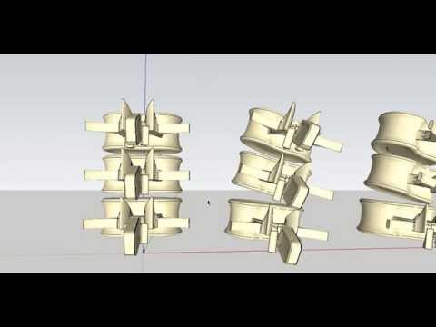 Hip Schweiz Die Symptome der Arthrose Schmerzen in der linken Hand