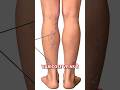 Varicose Vein क्यों और कैसे होता हैं Why Do 3 10 People Suffer F