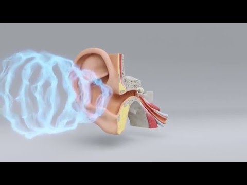 Explore the Science of Hearing Loss | Miracle-Ear Hearing Center