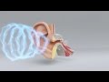 Miracle-Ear - The Science of Hearing Loss Miracle-Ear - The Science of Hearing Loss
