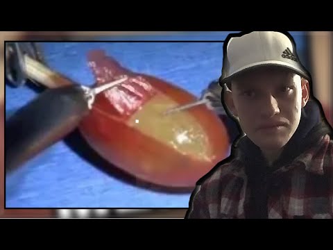 They Did Surgery On A Grape Memes Compilation Reaction