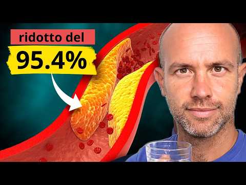 4 Factors to Clean Plaque in Arteries