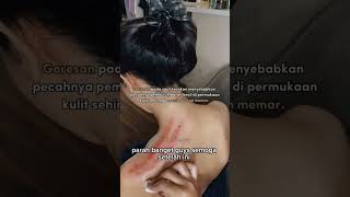 Download lagu Kerokan wanita #pijat #kerokan #kerokanwanita #kerokanmasukangin mp3 Download lagu Kerokan wanita #pijat #kerokan #kerokanwanita #kerokanmasukangin mp3