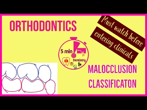 MALOCCLUSION | ANGLE'S CLASSIFICATION | ORTHODONTICS | 5 min DENTISTRY