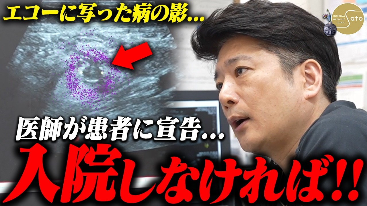 【衝撃】『緊急入院！？』女性患者を襲う腹部の激痛... 医師がエコー検査から見抜いた原因はまさかの「憩室炎」！？