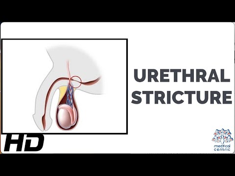 Effects of Cannabis on your body