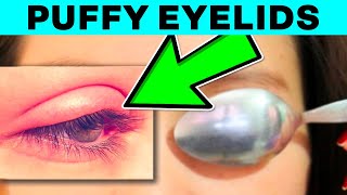 How To Get Rid Of Puffy Eyelids Naturally