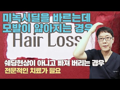 미녹시딜 발라도 모발이 가늘어진다면 단독 치료로는 안되고 전문적인 치료가 필요합니다.