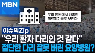 ＂우리 환자 다리인 것 같다＂ 절단한 다리 잘못 버린 요양병원? | 이슈픽 zip