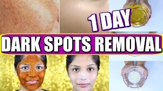 How To Remove Dark Spots On Face | 1 Day Skincare Routine For Spotless Skin |SuperPrincessjo