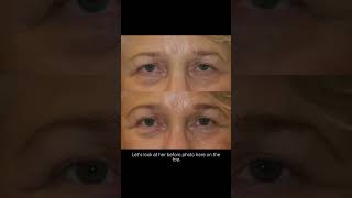 Nava Face & Eye