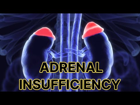 Adrenal Insufficiency (updated 2023) - CRASH! Medical Review Series