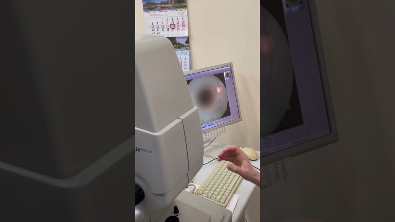 Ophthalmology class👁️ #mbbs #medicine #eyes #mbbsabroad #medical #students #study #viral  #shorts