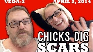 Chicks Dig Scars - VEDA 2