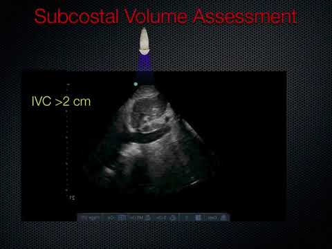 Echo Tutorial Ultrasound Comprehensive Transthoracic Echocardiogram