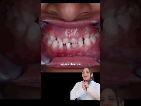 video f0rrJxnzIb4