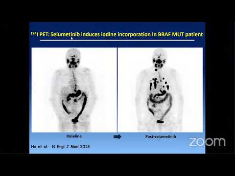 Biomolecular and Management of Thyroid Cancer Webinar