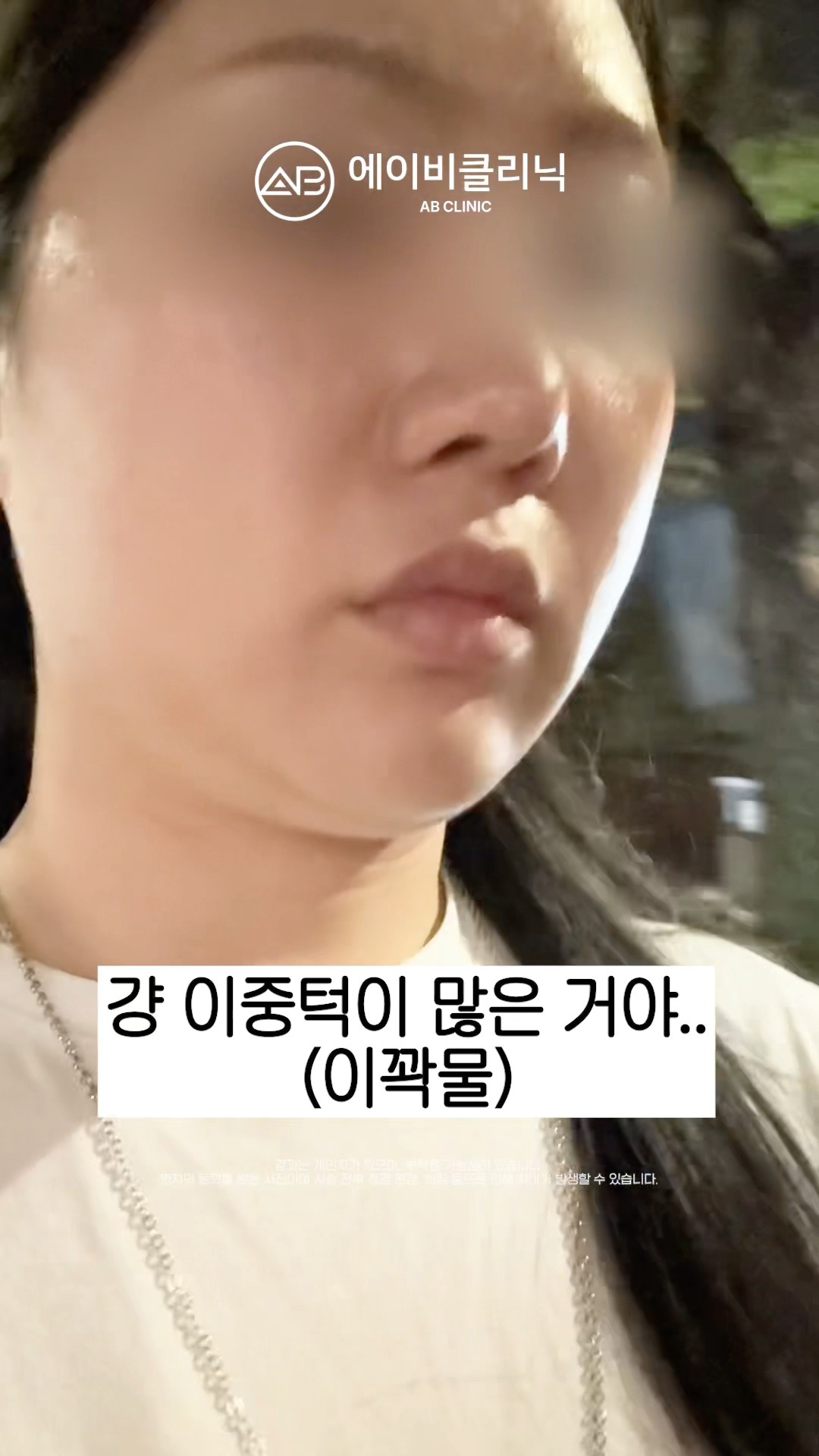 이중턱 실종 사건 🔥