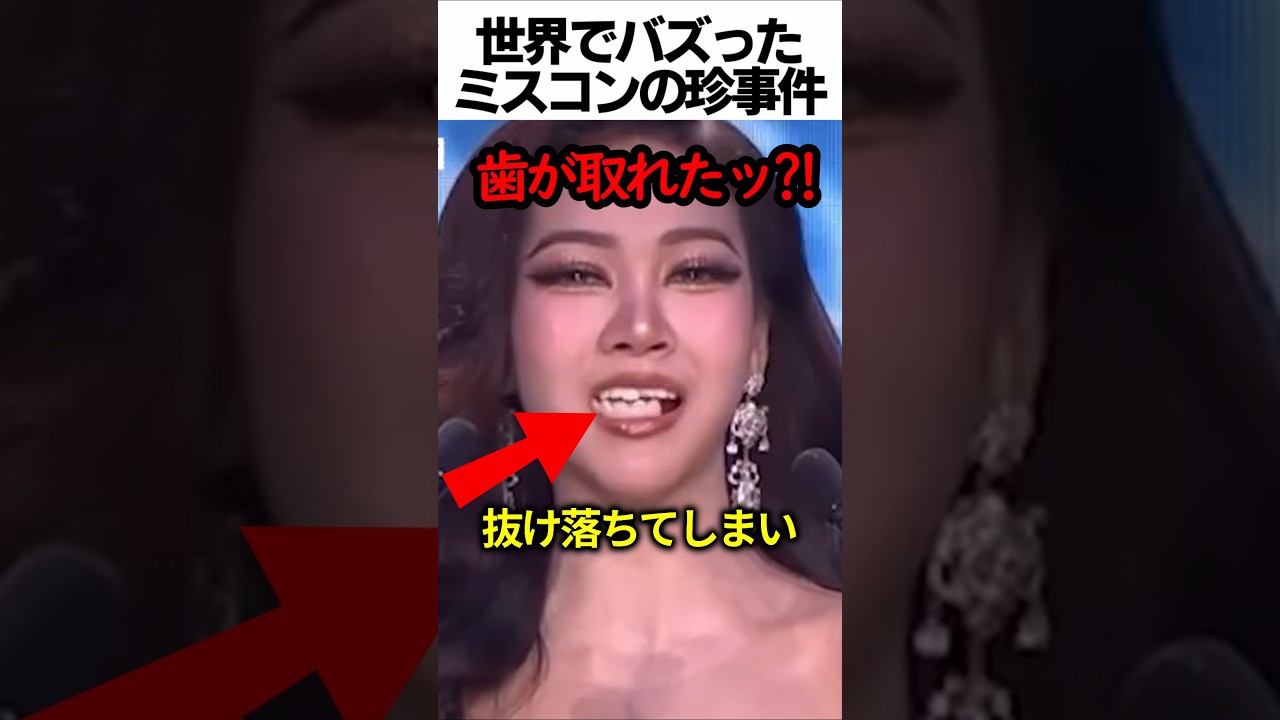 ミスタイランドで歯が取れる珍事件