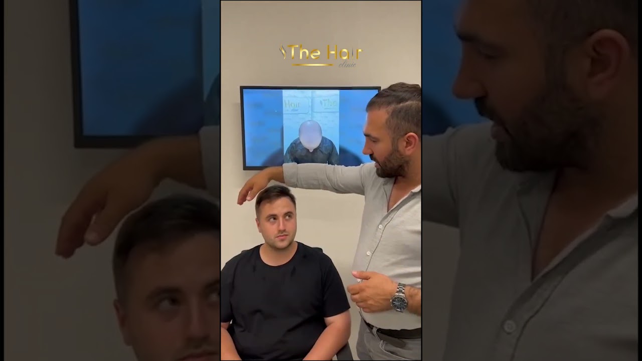 Saç Ekimi Hasta Yorumu