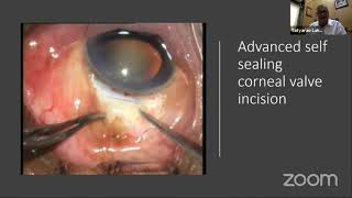 The Incision - Gateway to Safety. By Prof. Dr. T.P Lahane