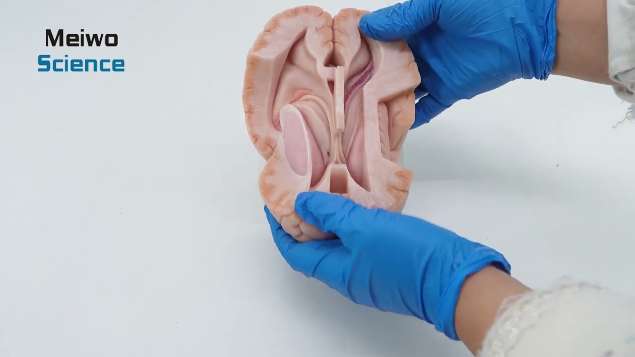 High Simulation Cerebral Ventricle Silicone Anatomy Model